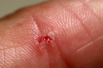 Believe it or not? Here is the proof!! A little wound of... 3mm!! I didn't know that she is a real cannibal!! :-)