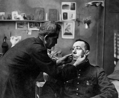 Soldier with mutilated face being fitted with a mask