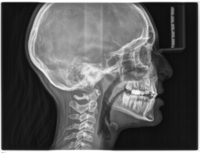 With this X-ray you cannot see the tooth.