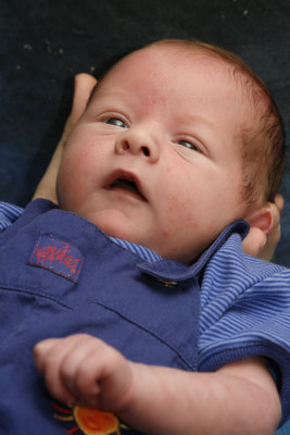 Jacob