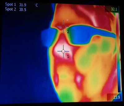 I've been thermal imaged