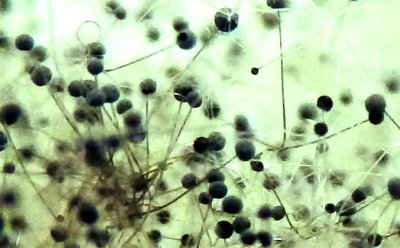Sporophores de la moisissure noire