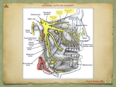 Lacrimal Outflow Surgery.014.jpeg
