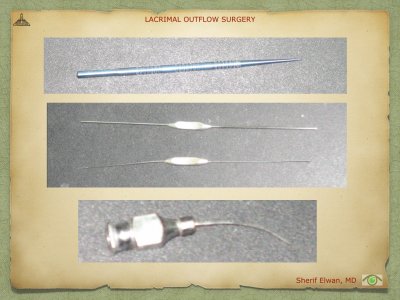 Lacrimal Outflow Surgery.024.jpeg