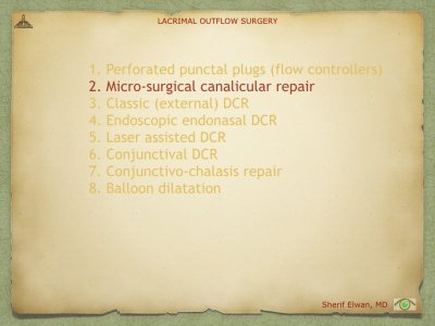 Lacrimal Outflow Surgery.041.jpeg