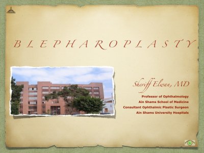 Blepharoplasty.001.jpeg