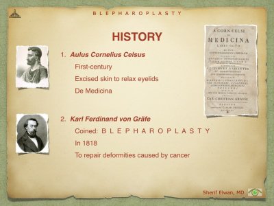 Blepharoplasty.004.jpeg