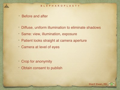 Blepharoplasty.016.jpeg