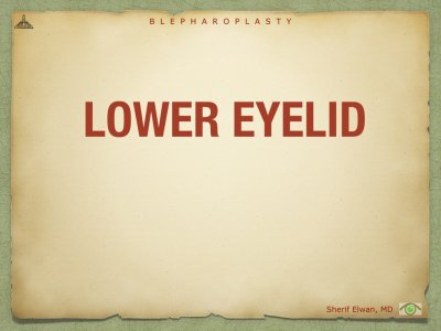 Blepharoplasty.066.jpeg