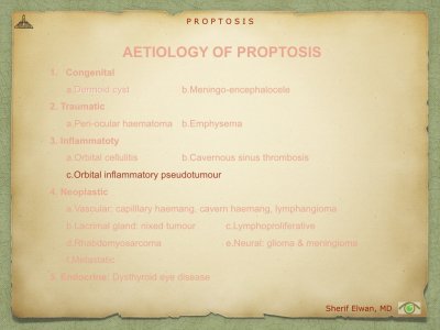 Proptosis.022.jpeg