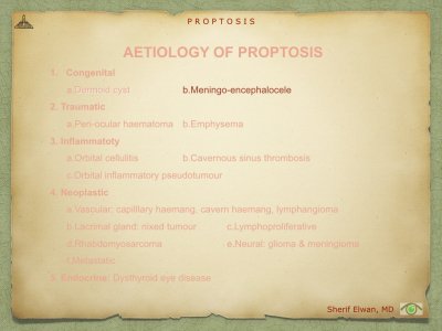 Proptosis.043.jpeg