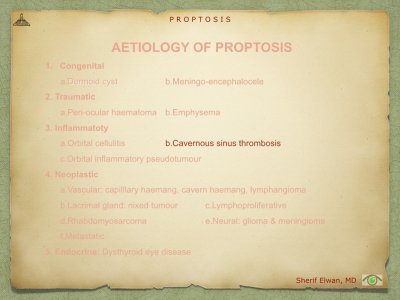 Proptosis.049.jpeg