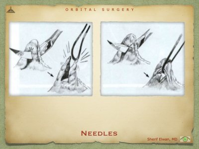 Needles & Sutures.006.jpeg