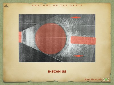 Anatomy of Orbit.053.jpeg