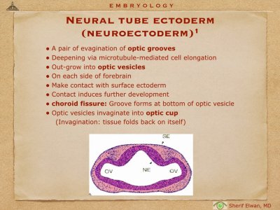 4.Ophth Embryology.004.jpeg