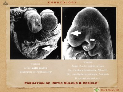 4.Ophth Embryology.007.jpeg