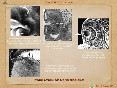 4.Ophth Embryology.009.jpeg