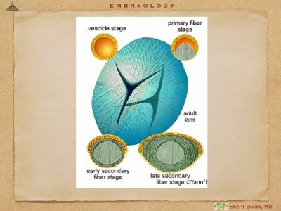 4.Ophth Embryology.010.jpeg