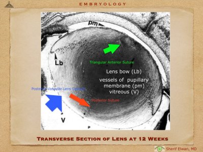 4.Ophth Embryology.012.jpeg
