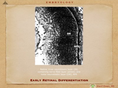 4.Ophth Embryology.014.jpeg