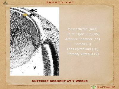 4.Ophth Embryology.017.jpeg