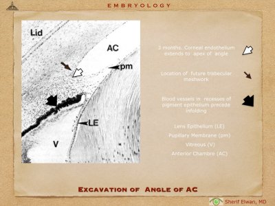 4.Ophth Embryology.020.jpeg