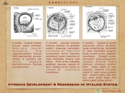 4.Ophth Embryology.022.jpeg