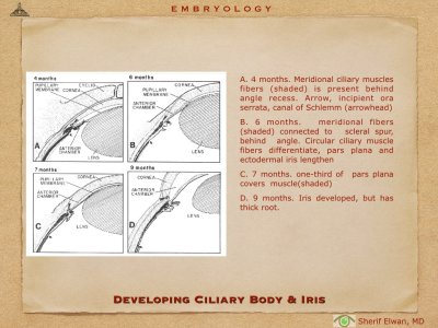 4.Ophth Embryology.024.jpeg