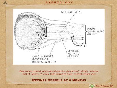 4.Ophth Embryology.025.jpeg