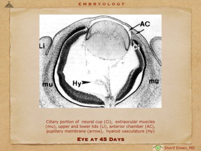 4.Ophth Embryology.026.jpeg