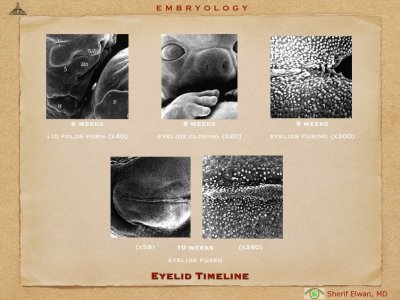 4.Ophth Embryology.027.jpeg