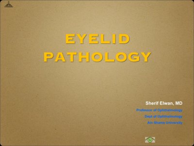 Histopathology of the Eyelids