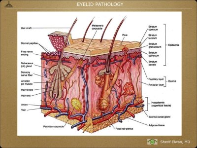 Pathology - Eyelids.003.jpeg