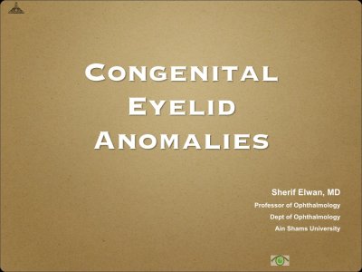 Congenital Eyelid Anomalies