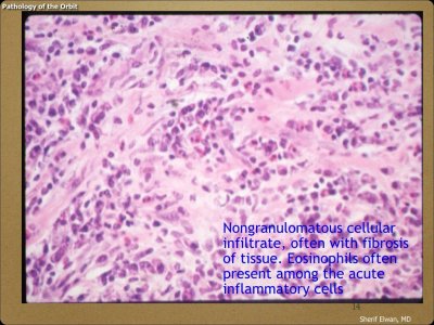 Pathology - Orbit.014.jpeg