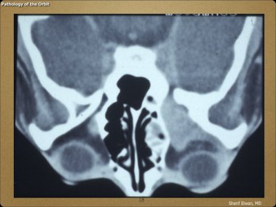 Pathology - Orbit.018.jpeg