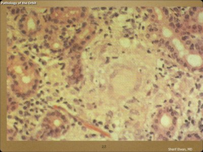 Pathology - Orbit.023.jpeg