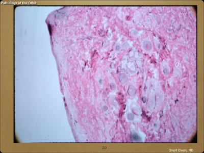 Pathology - Orbit.029.jpeg