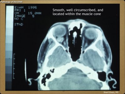 Pathology - Orbit.037.jpeg