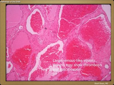 Pathology - Orbit.039.jpeg
