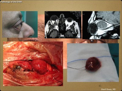 Pathology - Orbit.041.jpeg