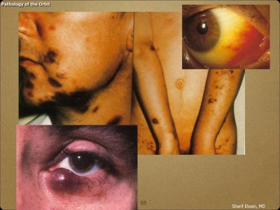 Pathology - Orbit.055.jpeg
