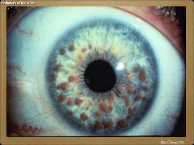 Pathology - Orbit.071.jpeg