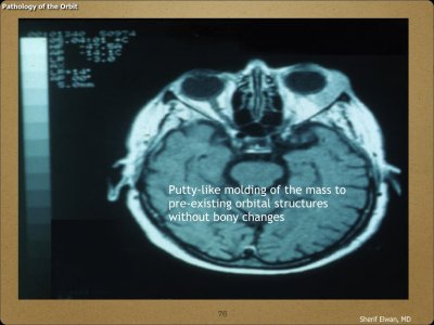 Pathology - Orbit.076.jpeg