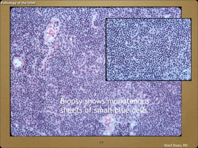 Pathology - Orbit.077.jpeg