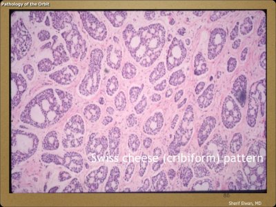 Pathology - Orbit.085.jpeg