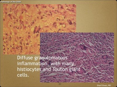 Pathology - Orbit.090.jpeg