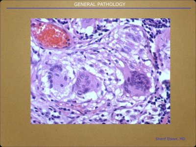 Pathology General.020.jpeg