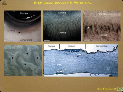 Pathology - Stem Cell.023.jpeg