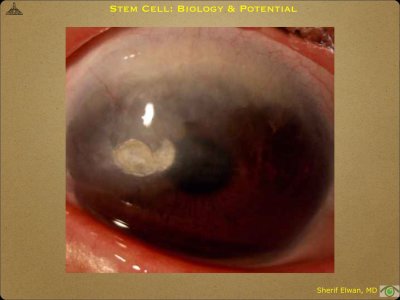 Pathology - Stem Cell.025.jpeg